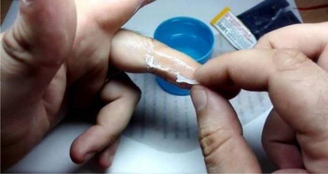 Как избавиться от суперклея, застывшего на пальцах (5 фото)